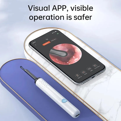 Smart Ear Care Camera Kit