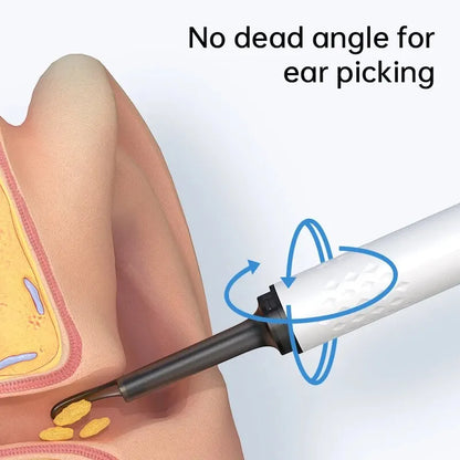 Smart Ear Care Camera Kit